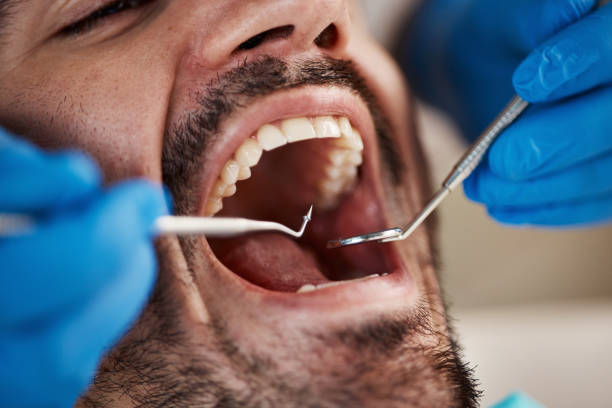 Fast & Reliable Emergency Dental Services in MD