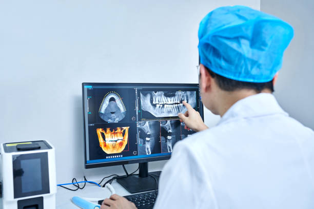 Best Emergency Treatment for Dental Infections or Abscesses in Fort Washington, MD